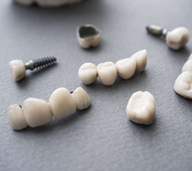South Gate The Difference Between Dental Implants and Mini Dental Implants